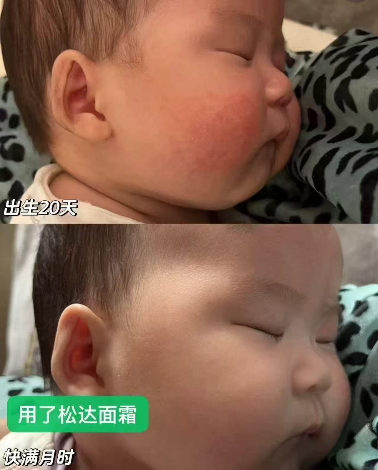 松达山茶油面霜50g*2瓶