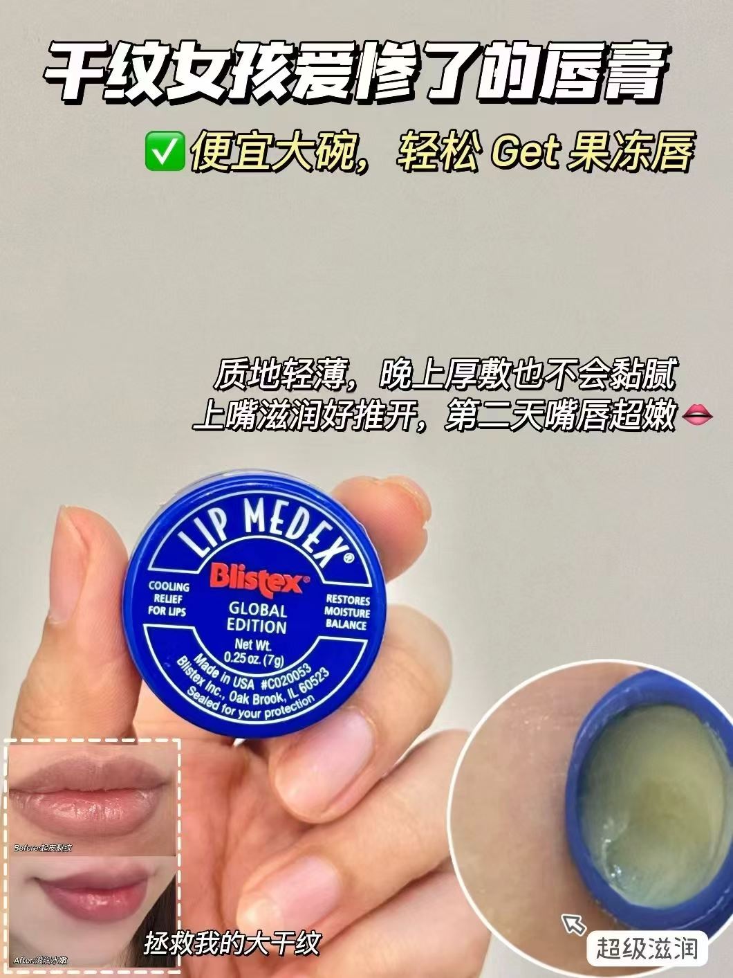 BLISTEX百蕾适碧唇小蓝罐