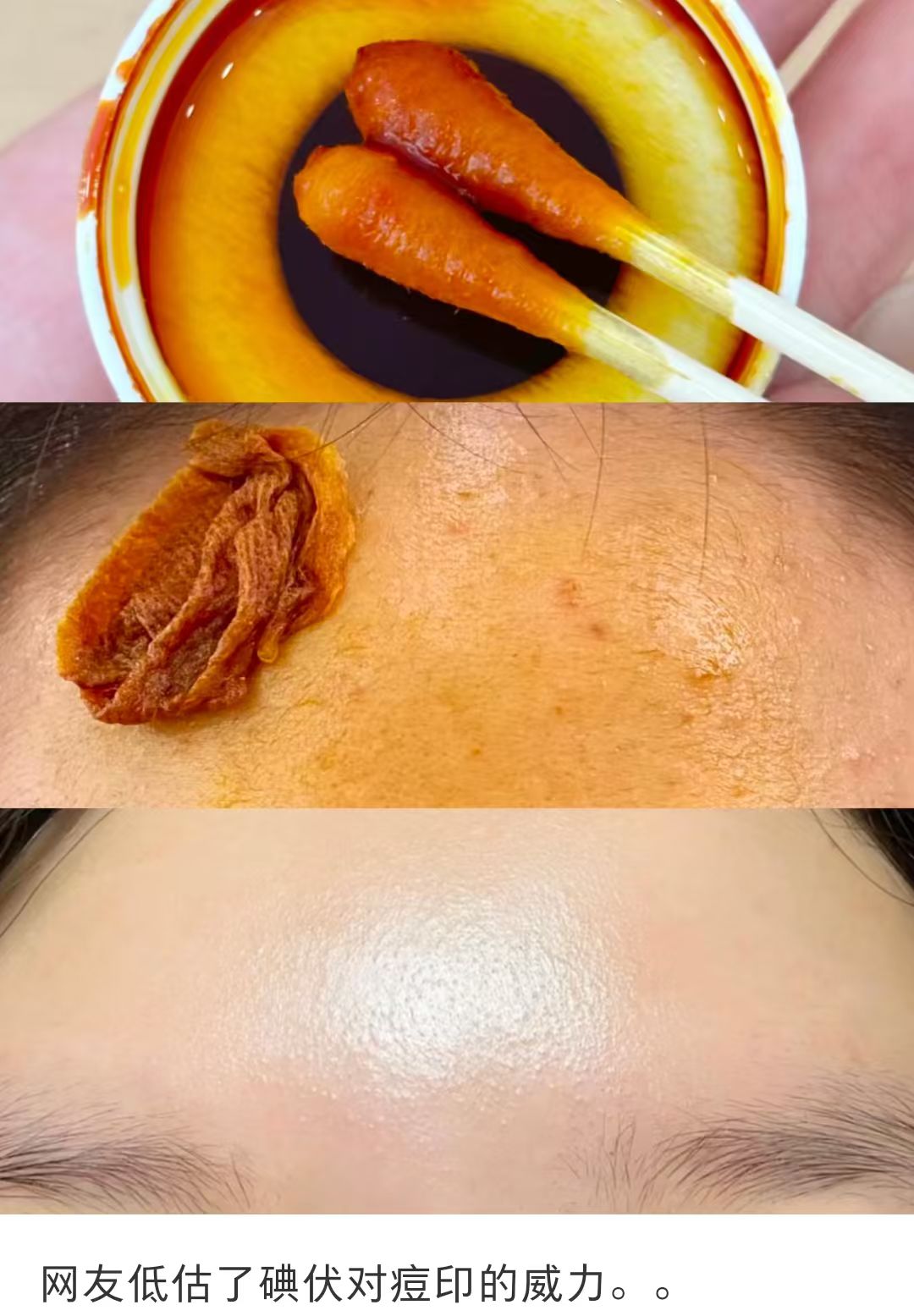 安多福PVP-I碘伏消毒液医用30ml*3